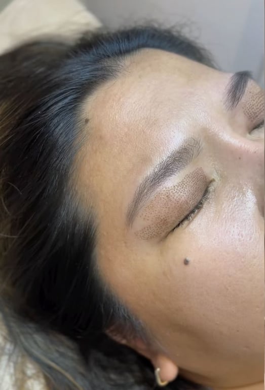 Mold Manila Spotlights Mold Plasma Lift: The Non-Surgical Alternative for Lids, Lines, and Sagging Skin